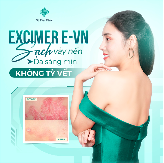 Thực hư liệu trình điều trị vẩy nến bằng công nghệ cao Eximer E - VN tại St.Paul Clinic?