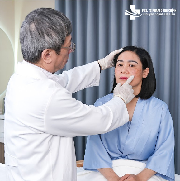 Hiểu đúng về nám da: Lời khuyên từ PGS.TS Phạm Công Chính